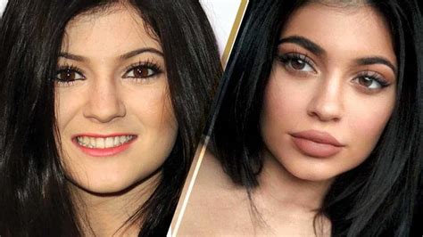 kylie jenner before and after|kim kardashian before plastic surgery.